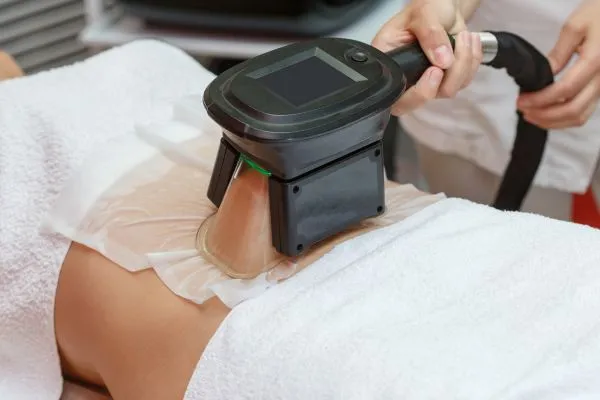 Image of person having fat freezing treatment to help weight gain Lewes