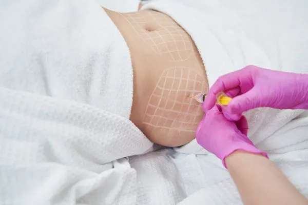 image of fat dissolving injections on love handles to help combat weight gain Lewes