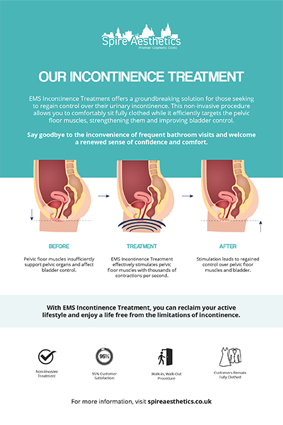 image to show how EMS treatment works for female urinary incontinence Lewes
