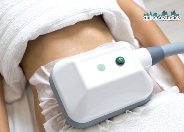 Shift Those Extra Pounds: How Fat Freezing Can Help You Slim Down Lewes